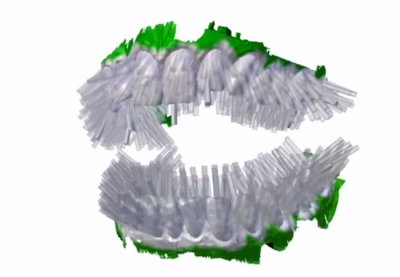 Szintén 3D-s nyomtatásra szánt, különleges fogkefe-elképzelés