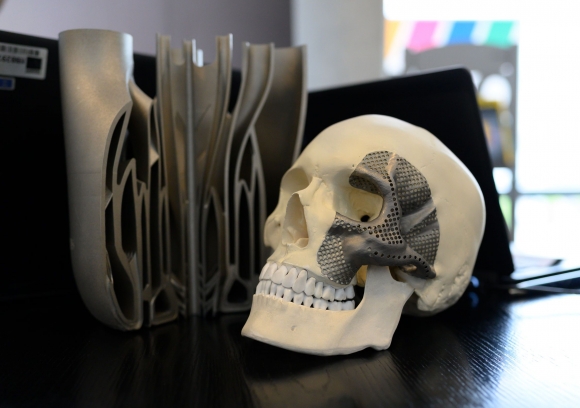 A 3D-nyomtatás egyik fő alkalmazója az orvostechnika, többek között koponyaimplantátum készítésére